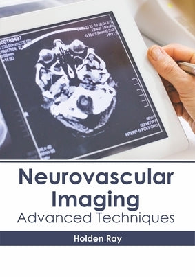 Neurovascular Imaging: Advanced Techniques by Ray, Holden