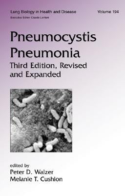 Pneumocystis Pneumonia by Walzer, Peter