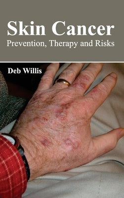 Skin Cancer: Prevention, Therapy and Risks by Willis, Deb