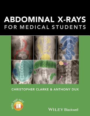 Abdominal X-Rays for Medical Students by Clarke, Christopher