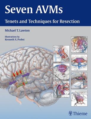 Seven Avms: Tenets and Techniques for Resection by Lawton, Michael T.