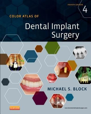 Color Atlas of Dental Implant Surgery by Block, Michael S.