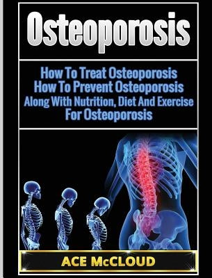 Osteoporosis: How To Treat Osteoporosis: How To Prevent Osteoporosis: Along With Nutrition, Diet And Exercise For Osteoporosis by McCloud, Ace