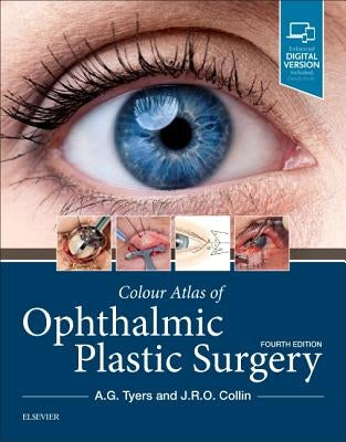 Colour Atlas of Ophthalmic Plastic Surgery by Tyers, Anthony G.