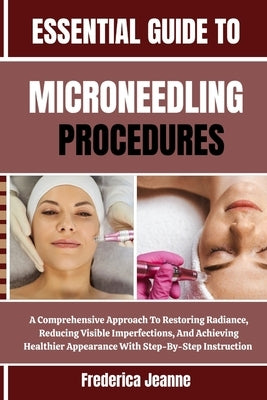 Essential Guide to Microneedling Procedures: A Comprehensive Approach To Restoring Radiance, Reducing Visible Imperfections, And Achieving Healthier A by Jeanne, Frederica