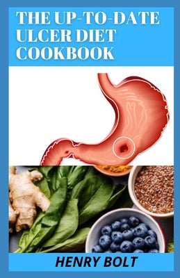 The Up-To-Date Ulcer Diet Cookbook: The 50+ Mouth-Watering, Healthy Recipes To Cure Ulcer by Bolt, Henry
