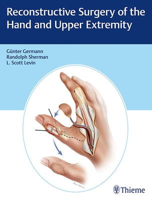 Reconstructive Surgery of the Hand and Upper Extremity by Germann, Günter