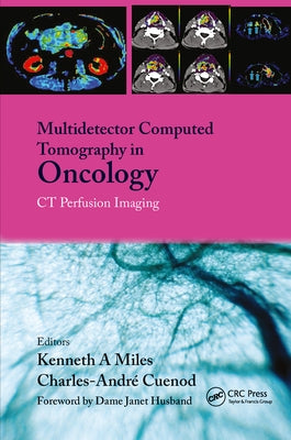 Multi-Detector Computed Tomography in Oncology: CT Perfusion Imaging by Miles, Kenneth