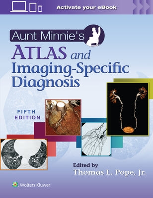 Aunt Minnie's Atlas and Imaging-Specific Diagnosis by Pope Jr, Thomas L.