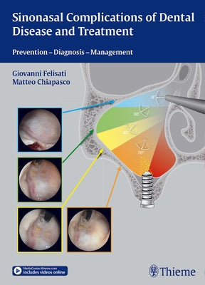 Sinonasal Complications of Dental Disease and Treatment: Prevention - Diagnosis - Management by Felisati, Giovanni