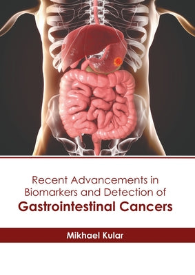 Recent Advancements in Biomarkers and Detection of Gastrointestinal Cancers by Kular, Mikhael
