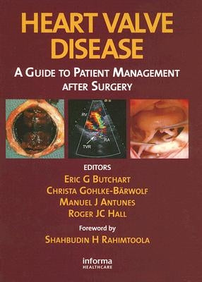 Heart Valve Disease: A Guide to Patient Management After Surgery by Butchart, Eric G.