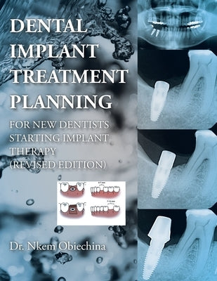 Dental Implant Treatment Planning for New Dentists Starting Implant Therapy by Obiechina, Nkem