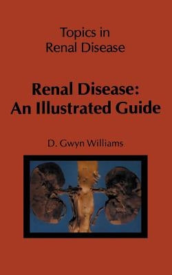 Renal Disease: An Illustrated Guide by Williams, D. G.