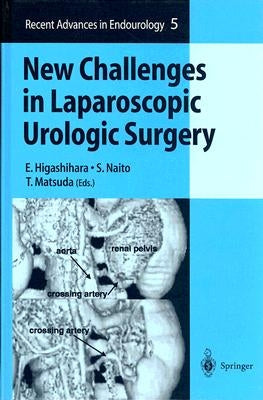 New Challenges in Laparoscopic Urologic Surgery by Higashihara, E.