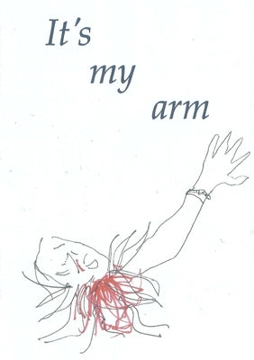 It's my arm by Weston, Tony