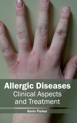 Allergic Diseases: Clinical Aspects and Treatment by Parker, Kevin