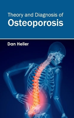 Theory and Diagnosis of Osteoporosis by Heller, Dan