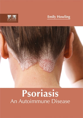 Psoriasis: An Autoimmune Disease by Howling, Emily