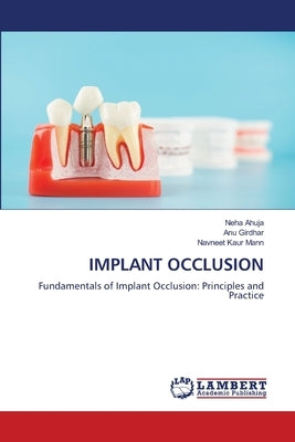Implant Occlusion by Ahuja, Neha