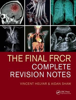 The Final Frcr: Complete Revision Notes by Helyar, Vincent