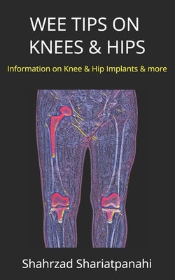 Wee Tips on Knees & Hips: Information on Knee & Hip Implants and More by Shariatpanahi, Shahrzad