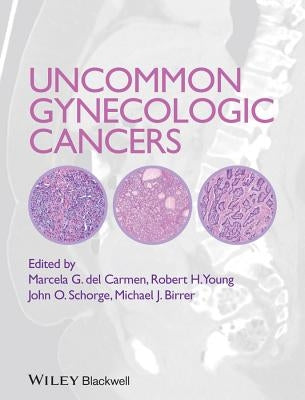 Uncommon Gynecologic Cancers by Del Carmen, Marcela