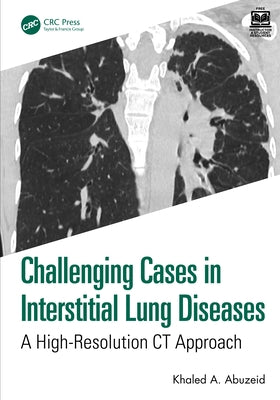 Challenging Cases in Interstitial Lung Diseases: A High-Resolution CT Approach by Abuzeid, Khaled Ahmed