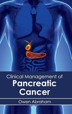 Clinical Management of Pancreatic Cancer by Abraham, Owen
