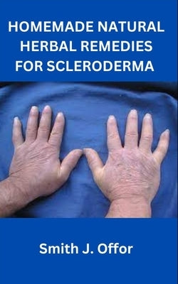Homemade Natural Herbal Remedies for Scleroderma by Offor, Smith J.