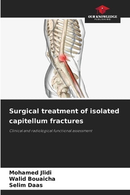 Surgical treatment of isolated capitellum fractures by Jlidi, Mohamed