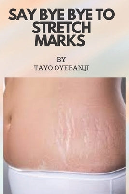 Say bye bye to stretch marks: Take back your confidence and send stretch marks out of your life! by Oyebanji, Tayo