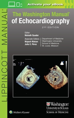 The Washington Manual of Echocardiography by Quader, Nishath