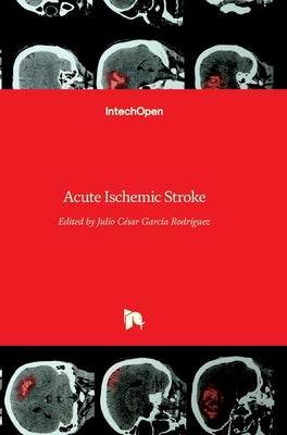 Acute Ischemic Stroke by Garcia Rodriguez, Julio Cesar