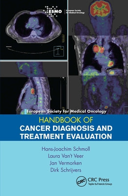 European Society for Medical Oncology Handbook of Cancer Diagnosis and Treatment Evaluation by Schmoll, Hans-Joachim