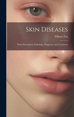 Skin Diseases: Their Description, Pathology, Diagnosis, and Treatment by Fox, Tilbury