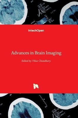 Advances in Brain Imaging by Chaudhary, Vikas
