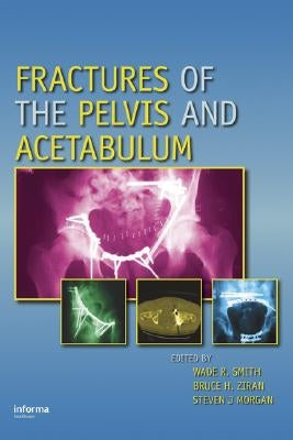 Fractures of the Pelvis and Acetabulum by Smith, Wade R.