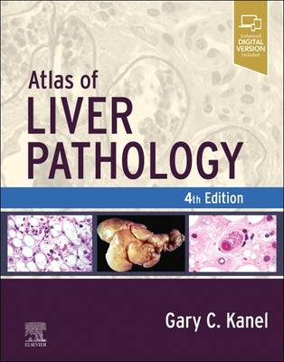 Atlas of Liver Pathology by Kanel, Gary C.