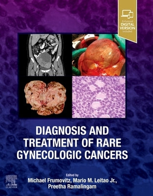 Diagnosis and Treatment of Rare Gynecologic Cancers by Frumovitz, Michael