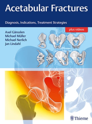 Acetabular Fractures: Diagnosis, Indications, Treatment Strategies by Gänsslen, Axel