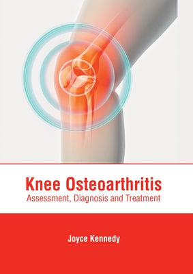 Knee Osteoarthritis: Assessment, Diagnosis and Treatment by Kennedy, Joyce