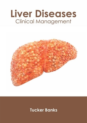Liver Diseases: Clinical Management by Banks, Tucker
