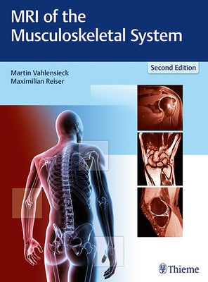 MRI of the Musculoskeletal System by Vahlensieck, Martin