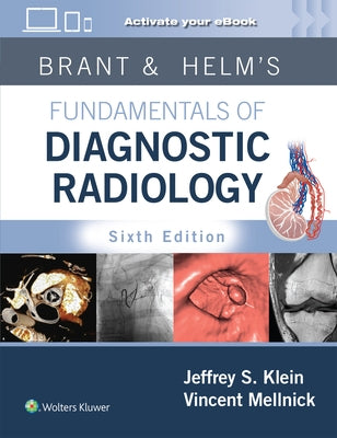 Brant & Helm's Fundamentals of Diagnostic Radiology: Print + eBook with Multimedia by Klein, Jeffrey