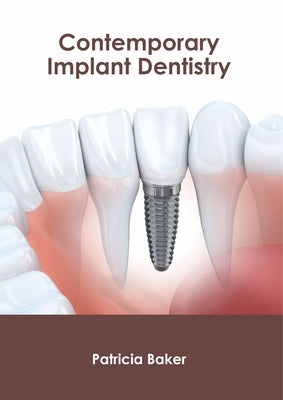 Contemporary Implant Dentistry by Baker, Patricia