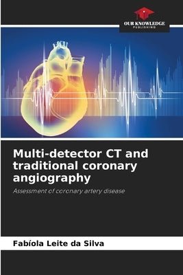 Multi-detector CT and traditional coronary angiography by Leite Da Silva, Fabíola