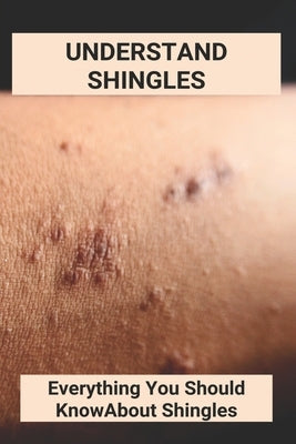 Understand Shingles: Everything You Should Know About Shingles: Shingles Topical Treatment by Dekine, Bula