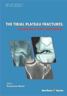 The Tibial Plateau Fractures: Diagnosis and Treatmment by Atzori, Francesco