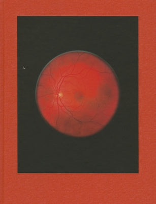 Michael Subotzky: Retinal Shift by Subotzky, Mikhael